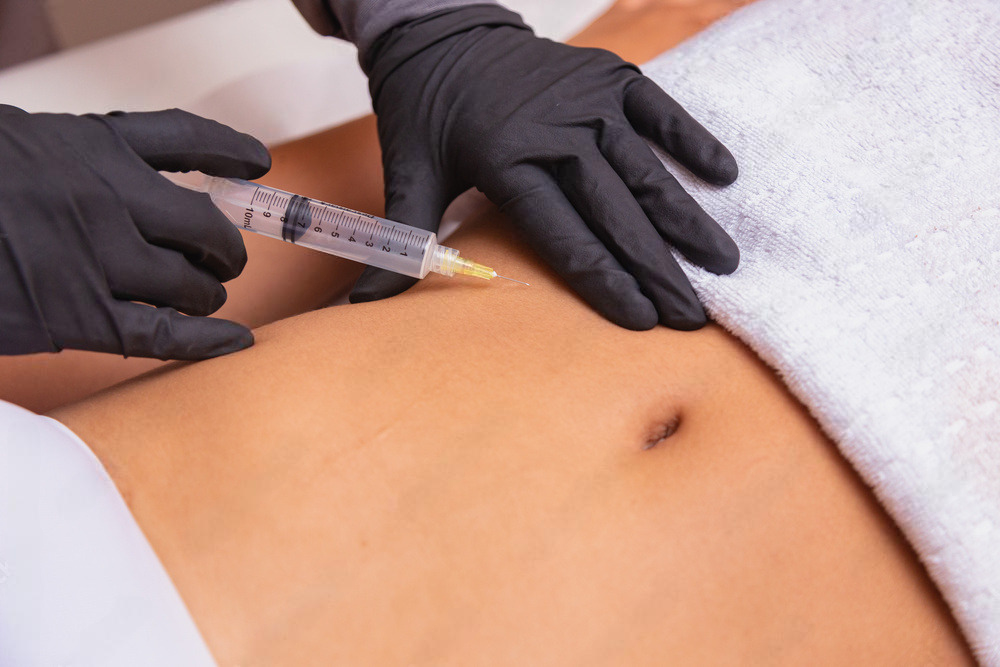 Hidrolipoclasia Não Aspirativa